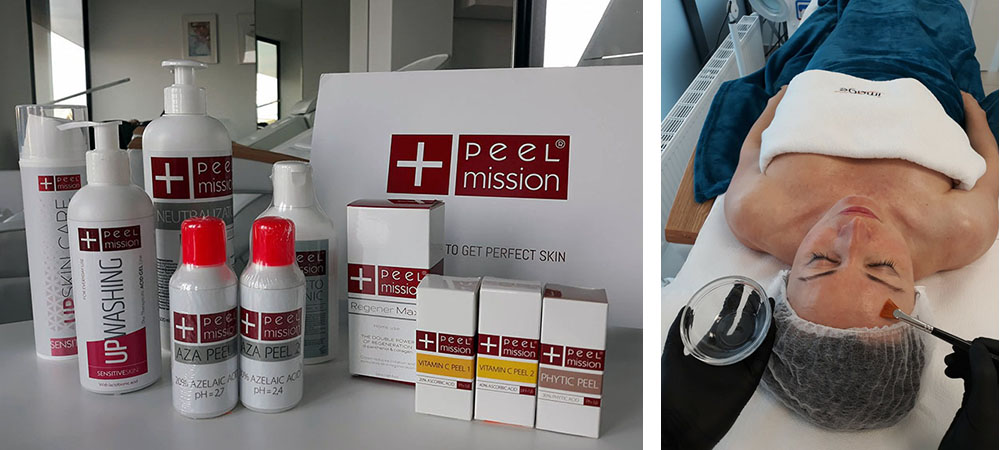 peel mission 1
