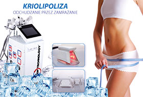 kriopoliza